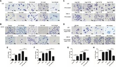 Irbesartan Ameliorates Lipid Deposition by Enhancing Autophagy via PKC/AMPK/ULK1 Axis in Free Fatty Acid Induced Hepatocytes